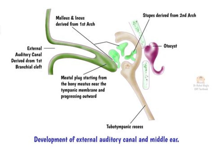 What is the middle ear normally filled with?