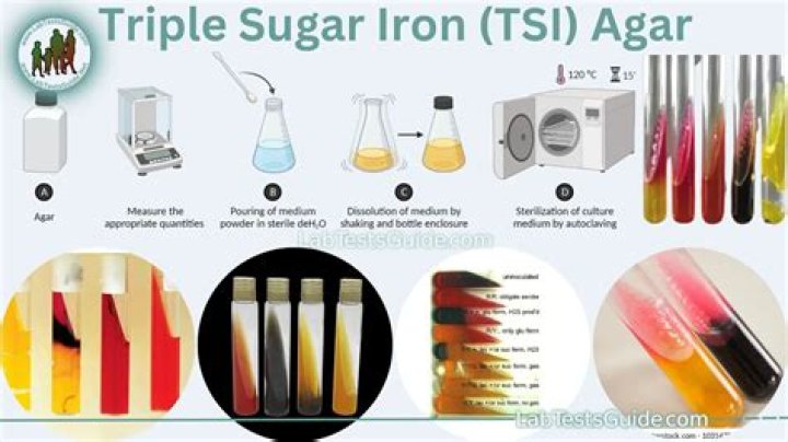 What three sugars are used in the triple sugar iron agar?