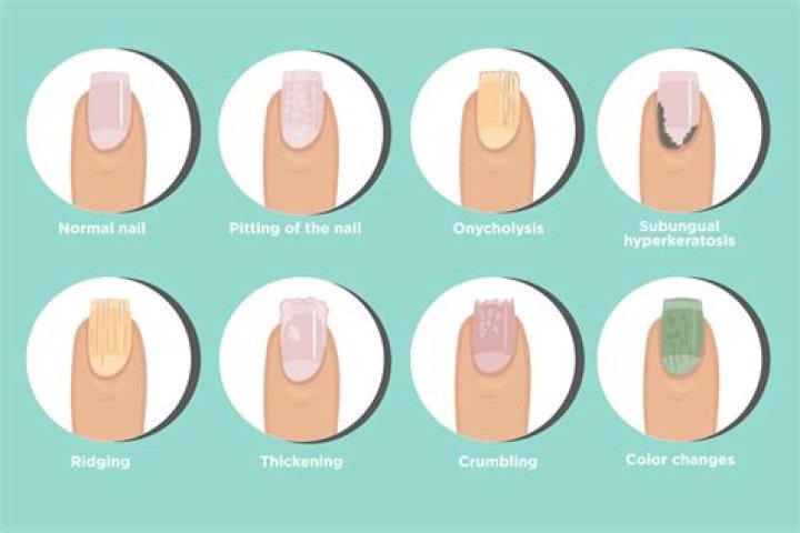 Why are my cuticles so dry and hard?