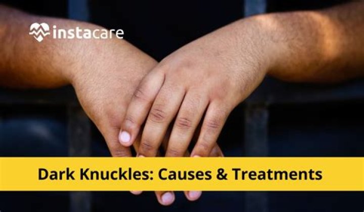 Why are my toe knuckles turning black?