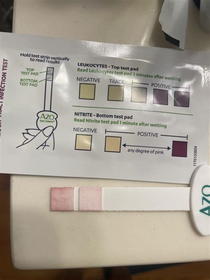 Why did test tube 5 yield a positive Iki test?