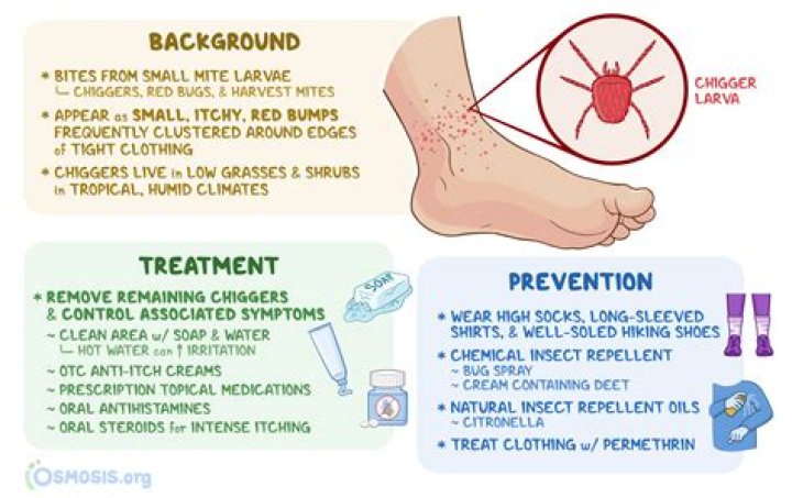 Why do I only have bug bites on my feet?