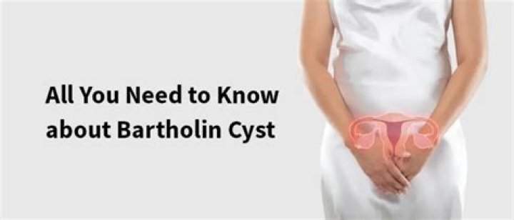Why does my Bartholin cyst keep coming back?