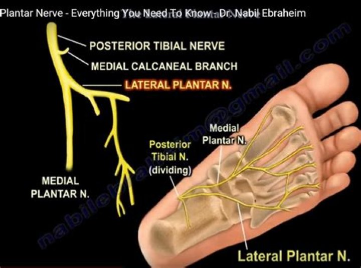 Why does my lateral plantar nerve hurt?